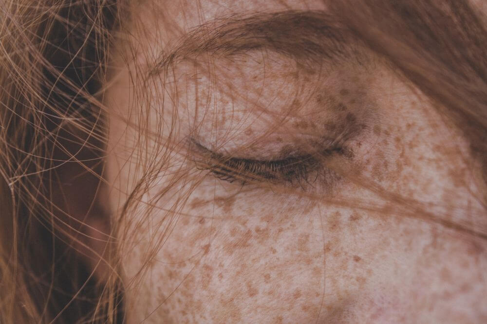 Red hair and freckles are not as common as you might think in Ireland. 